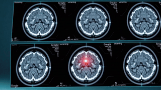 20250314_1026_AI Revolutionizes Medical Imaging_simple_compose_01jpav21b3fp89sd2xd4xqwp86
