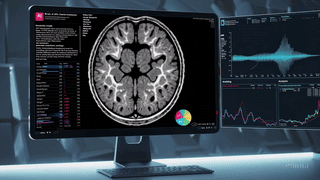 20250314_1135_AI Analyzes Brain MRI_simple_compose_01jpaz1qnefmnbhk2vcxgh224c
